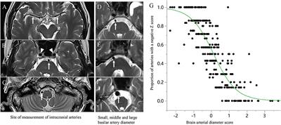 Caliber of Intracranial Arteries as a Marker for Cerebral Small Vessel Disease